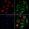 AF0366 staining Hela by IF/ICC. The samples were fixed with PFA and permeabilized in 0.1% Triton X-100,then blocked in 10% serum for 45 minutes at 25¡ãC. Samples were then incubated with primary Ab(AF0366 1:200) and mouse anti-beta tubulin Ab(T0023 1:200) for 1 hour at 37¡ãC. An  AlexaFluor594 conjugated goat anti-rabbit IgG(H+L) Ab(S0006 1:200 Red) and an AlexaFluor488 conjugated goat anti-mouse IgG(H+L) Ab(S0017 1:600 Green) were used as the secondary antibod