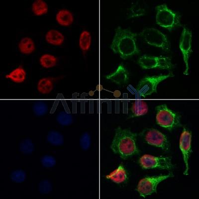 AF0366 staining Hela by IF/ICC. The samples were fixed with PFA and permeabilized in 0.1% Triton X-100,then blocked in 10% serum for 45 minutes at 25¡ãC. Samples were then incubated with primary Ab(AF0366 1:200) and mouse anti-beta tubulin Ab(T0023 1:200) for 1 hour at 37¡ãC. An  AlexaFluor594 conjugated goat anti-rabbit IgG(H+L) Ab(S0006 1:200 Red) and an AlexaFluor488 conjugated goat anti-mouse IgG(H+L) Ab(S0017 1:600 Green) were used as the secondary antibod