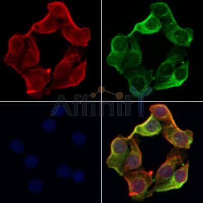 AF0375 staining Hela by IF/ICC. The samples were fixed with PFA and permeabilized in 0.1% Triton X-100,then blocked in 10% serum for 45 minutes at 25¡ãC. Samples were then incubated with primary Ab(AF0375 1:200) and mouse anti-beta tubulin Ab(T0023 1:200) for 1 hour at 37¡ãC. An  AlexaFluor594 conjugated goat anti-rabbit IgG(H+L) Ab(S0006 1:200 Red) and an AlexaFluor488 conjugated goat anti-mouse IgG(H+L) Ab(S0017 1:600 Green) were used as the secondary antibod