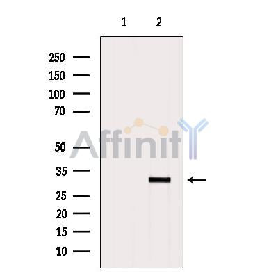 Western blot analysis of extracts from Hybridoma cells, using CIB3 Antibody. The lane on the left was treated with blocking peptide.