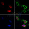 AF0425 staining HepG2 by IF/ICC. The samples were fixed with PFA and permeabilized in 0.1% Triton X-100,then blocked in 10% serum for 45 minutes at 25¡ãC. Samples were then incubated with primary Ab(AF0425 1:200) and mouse anti-beta tubulin Ab(T0023 1:200) for 1 hour at 37¡ãC. An  AlexaFluor594 conjugated goat anti-rabbit IgG(H+L) Ab(S0006 1:200 Red) and an AlexaFluor488 conjugated goat anti-mouse IgG(H+L) Ab(S0017 1:600 Green) were used as the secondary antibod
