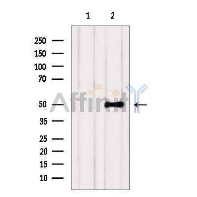 Western blot analysis of extracts from VERO, using ZNF436 Antibody. The lane on the left was treated with blocking peptide.