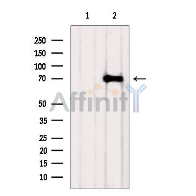 Western blot analysis of extracts from VERO, using DCLK3 Antibody. The lane on the left was treated with blocking peptide.