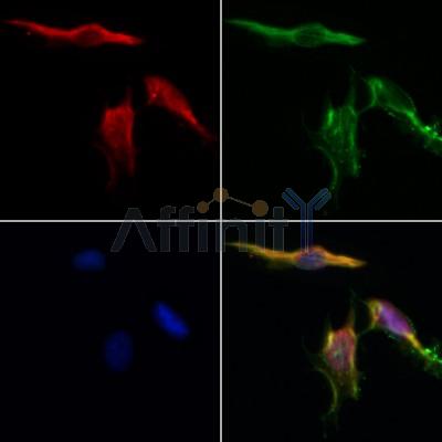 AF0441 staining HepG2 by IF/ICC. The samples were fixed with PFA and permeabilized in 0.1% Triton X-100,then blocked in 10% serum for 45 minutes at 25¡ãC. Samples were then incubated with primary Ab(AF0441 1:200) and mouse anti-beta tubulin Ab(T0023 1:200) for 1 hour at 37¡ãC. An  AlexaFluor594 conjugated goat anti-rabbit IgG(H+L) Ab(S0006 1:200 Red) and an AlexaFluor488 conjugated goat anti-mouse IgG(H+L) Ab(S0017 1:600 Green) were used as the secondary antibod