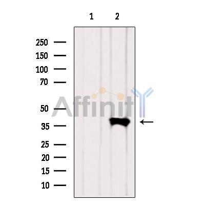 GAS41 Antibody