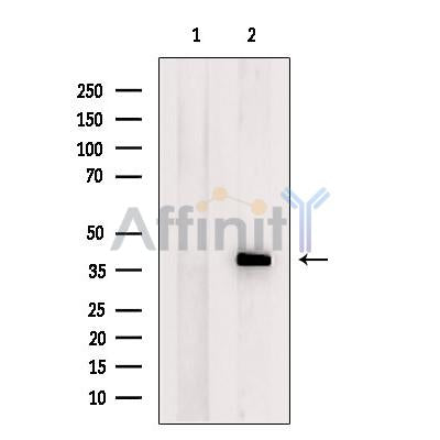 Western blot analysis of extracts from Mouse  brain, using FKBPL Antibody. The lane on the left was treated with blocking peptide.
