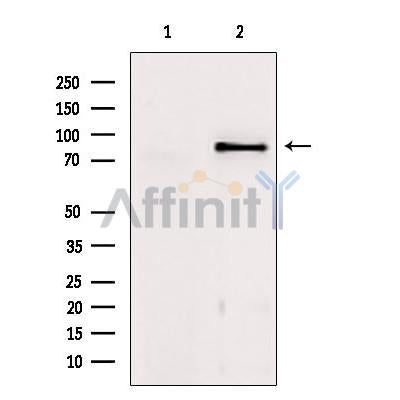 Western blot analysis of extracts from mouse brain, using TACC1 Antibody. Lane 1 was treated with the blocking peptide.