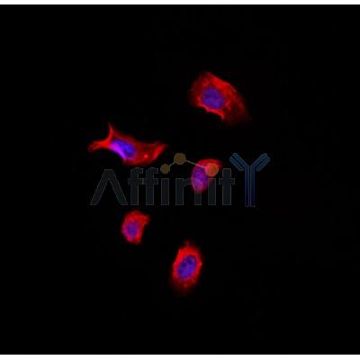 AF0456 staining Hela by IF/ICC. The sample were fixed with PFA and permeabilized in 0.1% Triton X-100,then blocked in 10% serum for 45 minutes at 25¡ãC. The primary antibody was diluted at 1/200 and incubated with the sample for 1 hour at 37¡ãC. An  Alexa Fluor 594 conjugated goat anti-rabbit IgG (H+L) Ab, diluted at 1/600, was used as the secondary antibod
