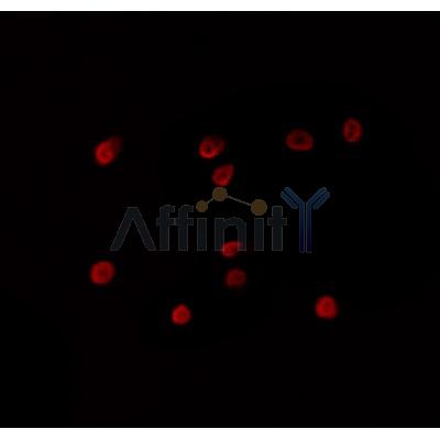 AF0464 staining HepG2 by IF/ICC. The sample were fixed with PFA and permeabilized in 0.1% Triton X-100,then blocked in 10% serum for 45 minutes at 25¡ãC. The primary antibody was diluted at 1/200 and incubated with the sample for 1 hour at 37¡ãC. An  Alexa Fluor 594 conjugated goat anti-rabbit IgG (H+L) Ab, diluted at 1/600, was used as the secondary antibod