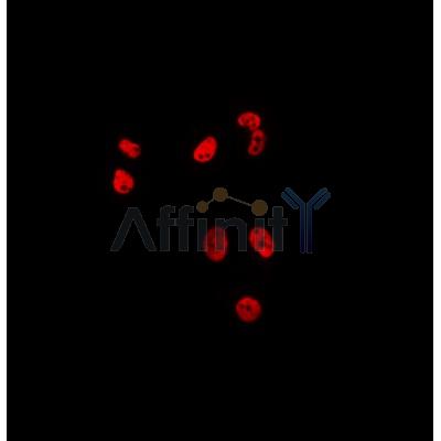 AF0497 staining Hela by IF/ICC. The sample were fixed with PFA and permeabilized in 0.1% Triton X-100,then blocked in 10% serum for 45 minutes at 25¡ãC. The primary antibody was diluted at 1/200 and incubated with the sample for 1 hour at 37¡ãC. An  Alexa Fluor 594 conjugated goat anti-rabbit IgG (H+L) Ab, diluted at 1/600, was used as the secondary antibod