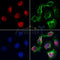 AF0508 staining Hela by IF/ICC. The samples were fixed with PFA and permeabilized in 0.1% Triton X-100,then blocked in 10% serum for 45 minutes at 25¡ãC. Samples were then incubated with primary Ab(AF0508 1:200) and mouse anti-beta tubulin Ab(T0023 1:200) for 1 hour at 37¡ãC. An  AlexaFluor594 conjugated goat anti-rabbit IgG(H+L) Ab(S0006 1:200 Red) and an AlexaFluor488 conjugated goat anti-mouse IgG(H+L) Ab(S0017 1:600 Green) were used as the secondary antibod