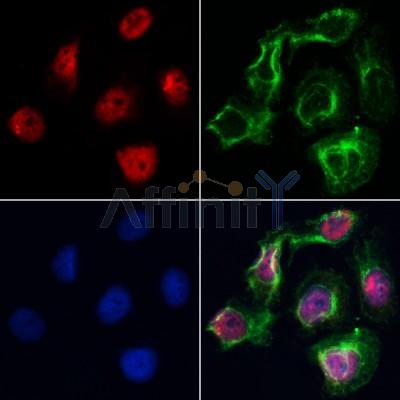 AF0508 staining Hela by IF/ICC. The samples were fixed with PFA and permeabilized in 0.1% Triton X-100,then blocked in 10% serum for 45 minutes at 25¡ãC. Samples were then incubated with primary Ab(AF0508 1:200) and mouse anti-beta tubulin Ab(T0023 1:200) for 1 hour at 37¡ãC. An  AlexaFluor594 conjugated goat anti-rabbit IgG(H+L) Ab(S0006 1:200 Red) and an AlexaFluor488 conjugated goat anti-mouse IgG(H+L) Ab(S0017 1:600 Green) were used as the secondary antibod