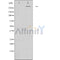 AF0547 staining HuvEc by IF/ICC. The sample were fixed with PFA and permeabilized in 0.1% Triton X-100,then blocked in 10% serum for 45 minutes at 25¡ãC. The primary antibody was diluted at 1/200 and incubated with the sample for 1 hour at 37¡ãC. An  Alexa Fluor 594 conjugated goat anti-rabbit IgG (H+L) Ab, diluted at 1/600, was used as the secondary antibod