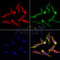 AF0581 staining HepG2 by IF/ICC. The sample were fixed with PFA and permeabilized in 0.1% Triton X-100,then blocked in 10% serum for 45 minutes at 25¡ãC. The primary antibody was diluted at 1/200 and incubated with the sample for 1 hour at 37¡ãC. An  Alexa Fluor 594 conjugated goat anti-rabbit IgG (H+L) Ab, diluted at 1/600, was used as the secondary antibod