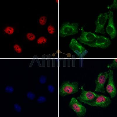 AF0635 staining 293 by IF/ICC. The sample were fixed with PFA and permeabilized in 0.1% Triton X-100,then blocked in 10% serum for 45 minutes at 25¡ãC. The primary antibody was diluted at 1/200 and incubated with the sample for 1 hour at 37¡ãC. An  Alexa Fluor 594 conjugated goat anti-rabbit IgG (H+L) Ab, diluted at 1/600, was used as the secondary antibod