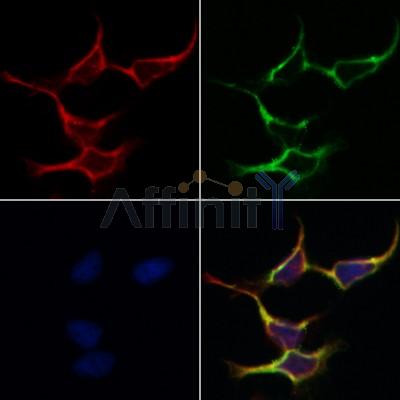 AF0711 at 1/100 staining human brain tissue sections by IHC-P. The tissue was formaldehyde fixed and a heat mediated antigen retrieval step in citrate buffer was performed. The tissue was then blocked and incubated with the antibody for 1.5 hours at 22¡ãC. An HRP conjugated goat anti-rabbit antibody was used as the secondary