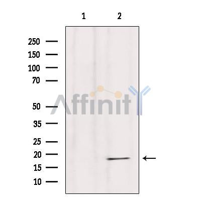 Western blot analysis of extracts from various samples, using Histone H4 Antibody.
 Lane 1: Hybridoma cells treated with blocking peptide;
 Lane 2: Hybridoma cells;
Lane 3: HeLa cells;
Lane 4: Vero cells;
Lane 5: Mouse lung tissue.