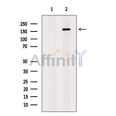 AS160 Antibody -AF2618