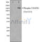 AF3204 staining Hela by IF/ICC. The sample were fixed with PFA and permeabilized in 0.1% Triton X-100,then blocked in 10% serum for 45 minutes at 25¡ãC. The primary antibody was diluted at 1/200 and incubated with the sample for 1 hour at 37¡ãC. An  Alexa Fluor 594 conjugated goat anti-rabbit IgG (H+L) Ab, diluted at 1/600, was used as the secondary antibod