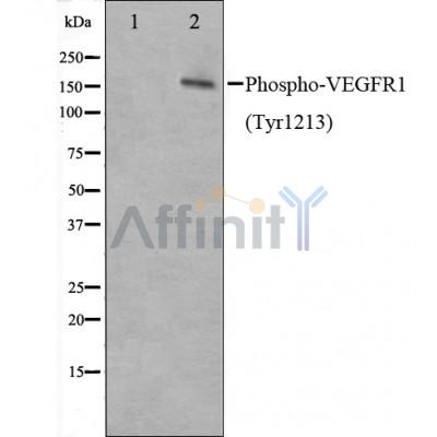 AF3204 staining Hela by IF/ICC. The sample were fixed with PFA and permeabilized in 0.1% Triton X-100,then blocked in 10% serum for 45 minutes at 25¡ãC. The primary antibody was diluted at 1/200 and incubated with the sample for 1 hour at 37¡ãC. An  Alexa Fluor 594 conjugated goat anti-rabbit IgG (H+L) Ab, diluted at 1/600, was used as the secondary antibod