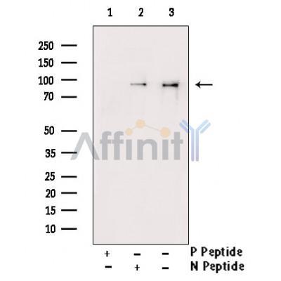 Phospho-STAT1 (Tyr701) Antibody