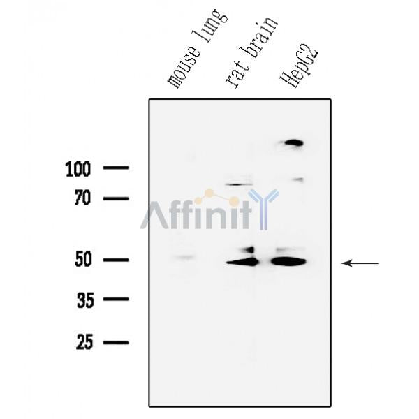 Phospho-Parkin (Ser65) Antibody -AF3500