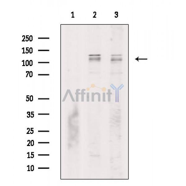 Phospho-MORC2 (Ser615) Antibody -AF3501