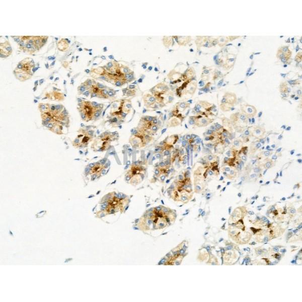 Phospho-MAFB (Ser304) Antibody -AF3504