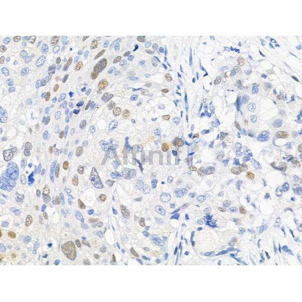 Phospho-KDM3A (Tyr1114) Antibody -AF3506