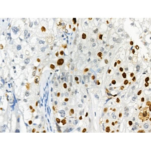 Phospho-DYRK1A/B (Tyr319/Tyr271) Antibody -AF3507