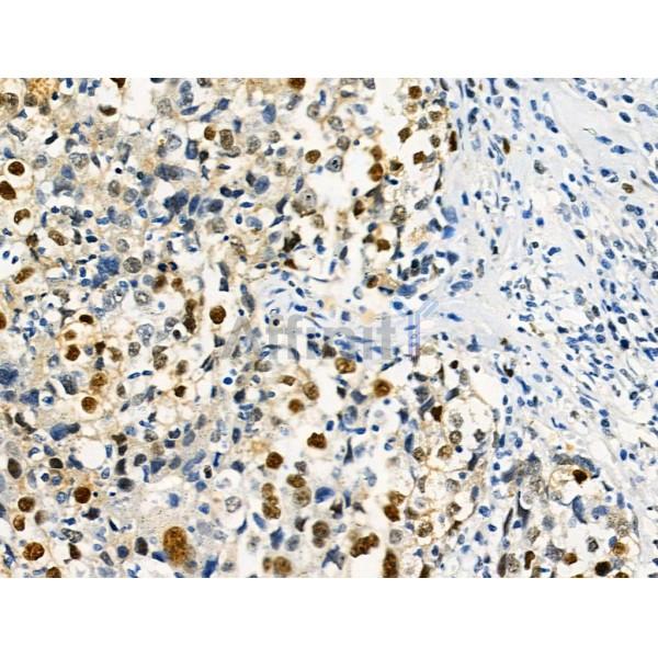 Phospho-SAMHD1 (Thr592) Antibody -AF3508