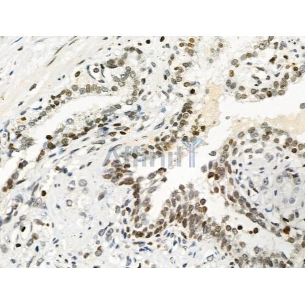 Phospho-Calsenilin/KCNIP3 (Ser63) Antibody -AF3509