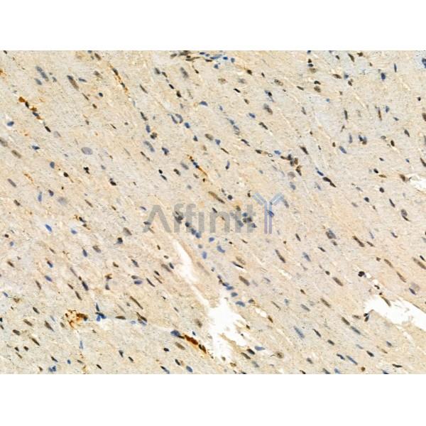 Phospho-PIN4 (Tyr122) Antibody -AF3511