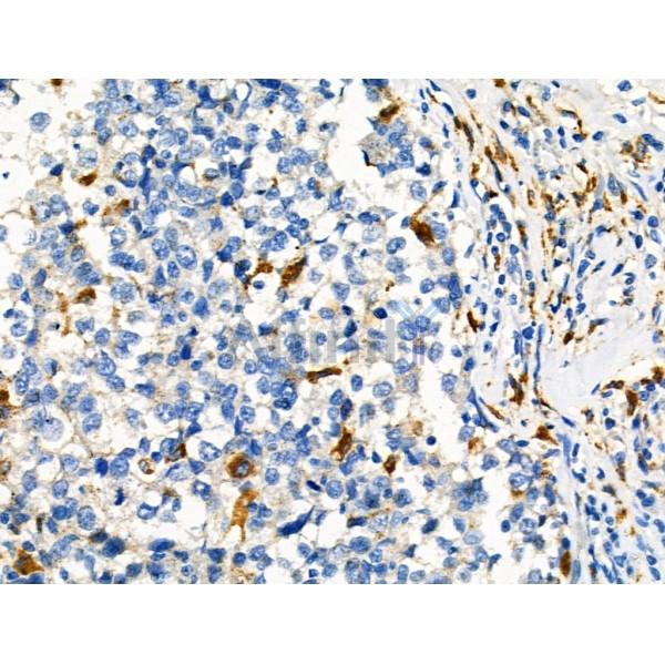 Phospho-STUB1/CHIP (Ser19) Antibody -AF3514
