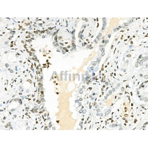 Phospho-PYCARD (Ser195) Antibody -AF3515