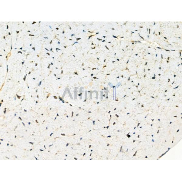 Phospho-TAO2 (Ser181) Antibody -AF3516