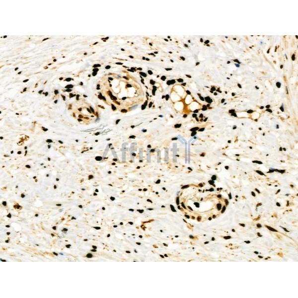 Phospho-PAK5/6 (Ser602/Ser560) Antibody -AF3522