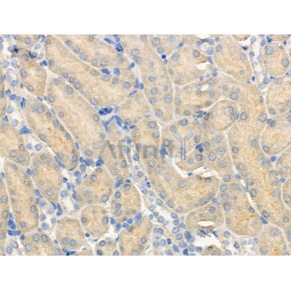 Phospho-PERK (Ser715) Antibody -AF3523