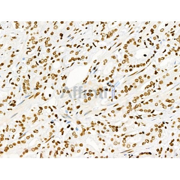 Phospho-hFANCI (Ser565) Antibody -AF3526
