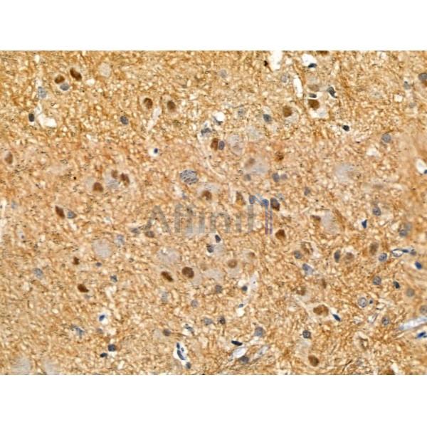 Phospho-SALL1 (Ser941) Antibody -AF3528