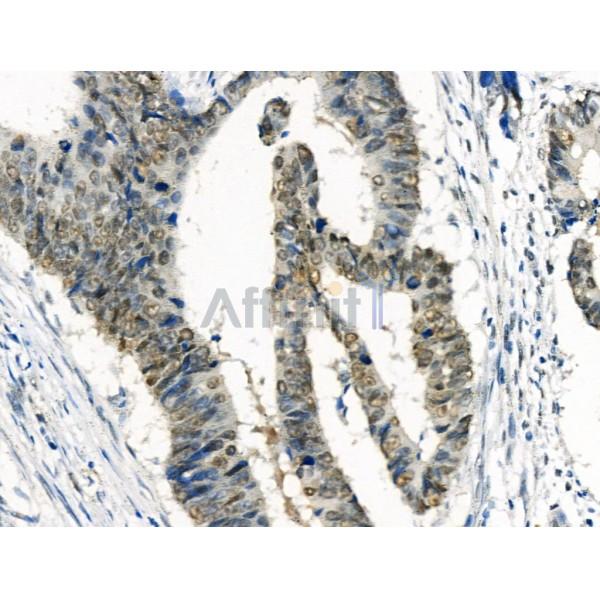 Phospho-RAD18 (Ser99) Antibody -AF3529
