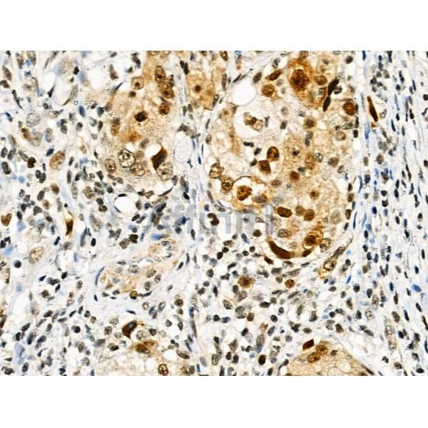 Phospho-RAD18 (Ser471) Antibody -AF3530