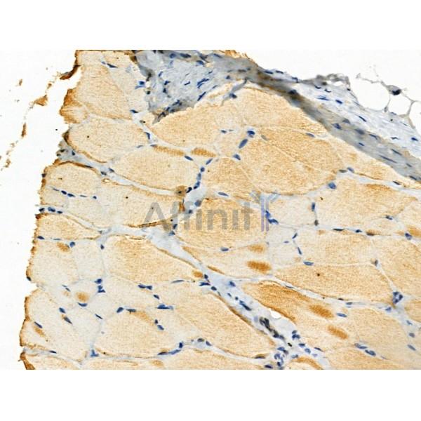 Phospho-SPHK2 (Ser387) Antibody -AF3532