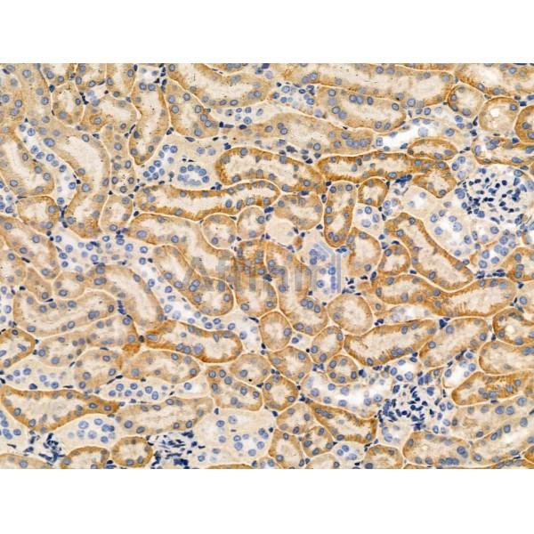 Phospho-WNK1 (Thr60) Antibody -AF3536