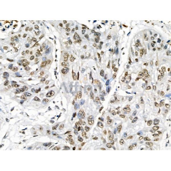 Phospho-Foxp3 (Ser19) Antibody -AF3544