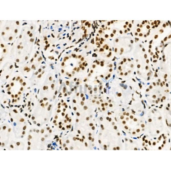 Phospho-MAP3K3 (Ser166) Antibody -AF3545