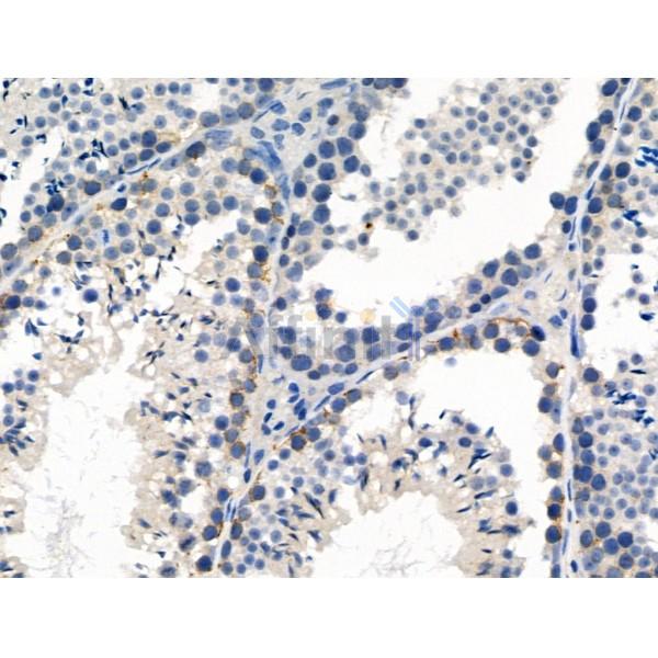 Phospho-ASK1 (Thr845) Antibody -AF3550
