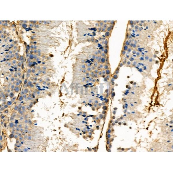 Phospho-PBK/TOPK (Ser32) Antibody -AF3556