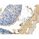 Phospho-WNK4 (Ser575) Antibody -AF3557