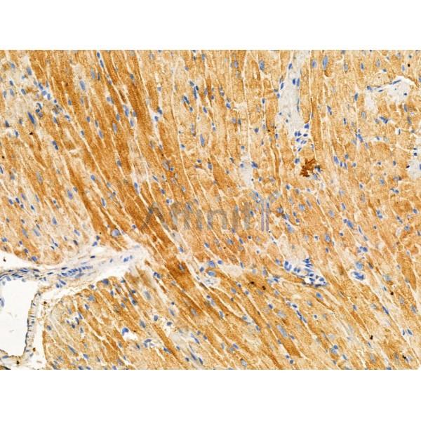 Phospho-OTUB1 (Ser16) Antibody -AF3558